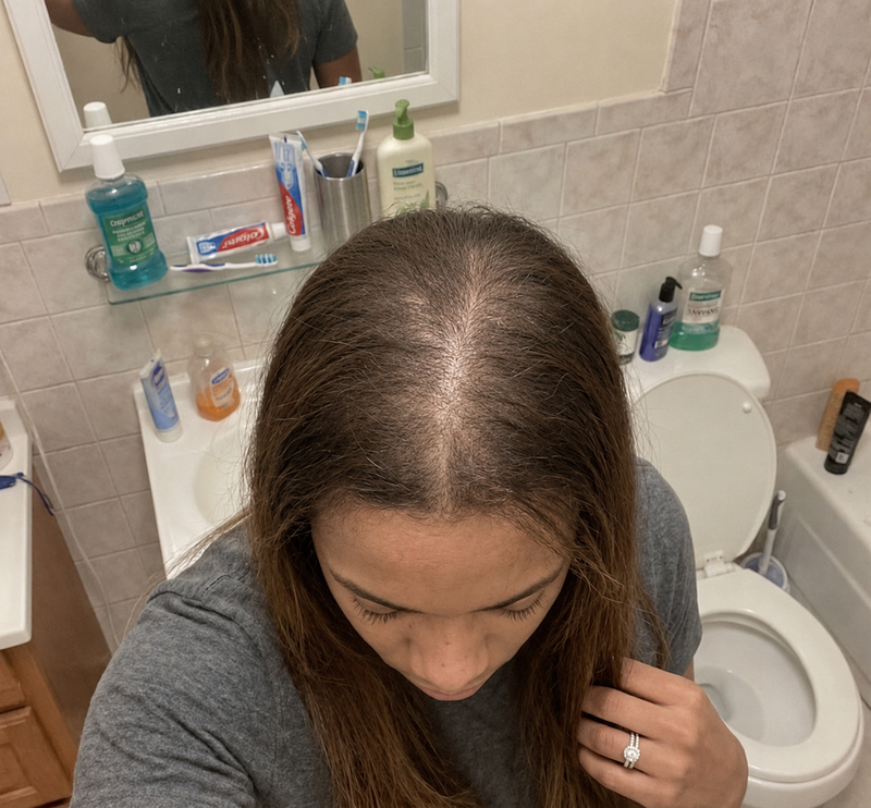 Before photo